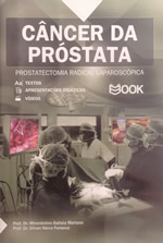 Câncer da Próstata – Prostatectomia Radical Laparoscópica